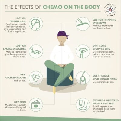 effecten van chemotherapie en radiotherapie in infographics.